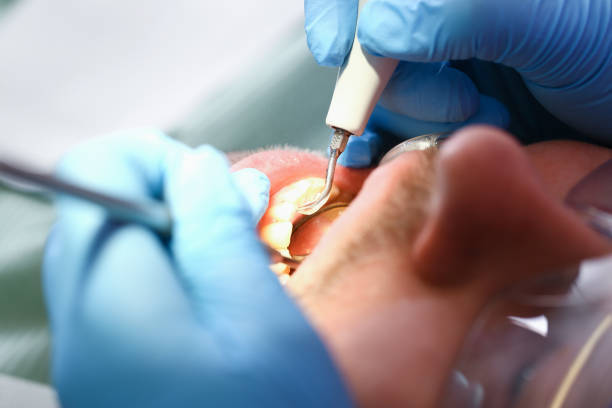 Best Weekend Emergency Dentist in Whitney, TX