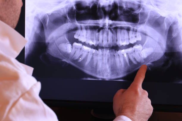 Best Emergency Dental Extractions in Whitney, TX