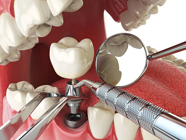 Best Emergency Dentist for Special Needs Patients in Whitney, TX